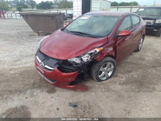 Photo 5 VIN: KMHDH4AE6BU120291 - HYUNDAI ELANTRA 