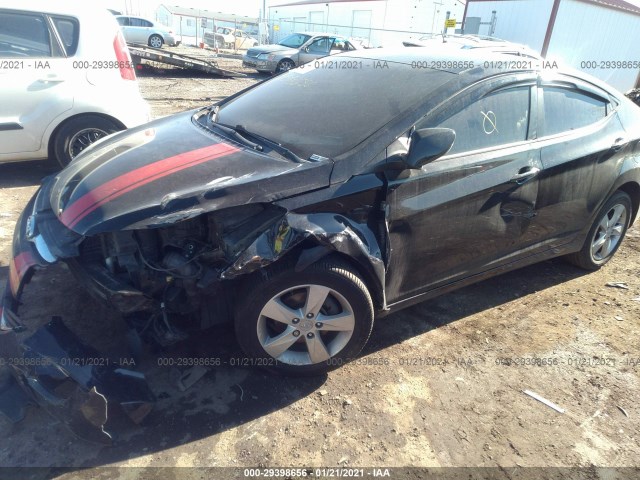 Photo 5 VIN: KMHDH4AE6BU121134 - HYUNDAI ELANTRA 