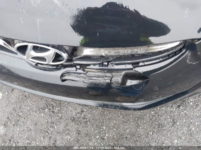 Photo 5 VIN: KMHDH4AE6CU227259 - HYUNDAI ELANTRA 