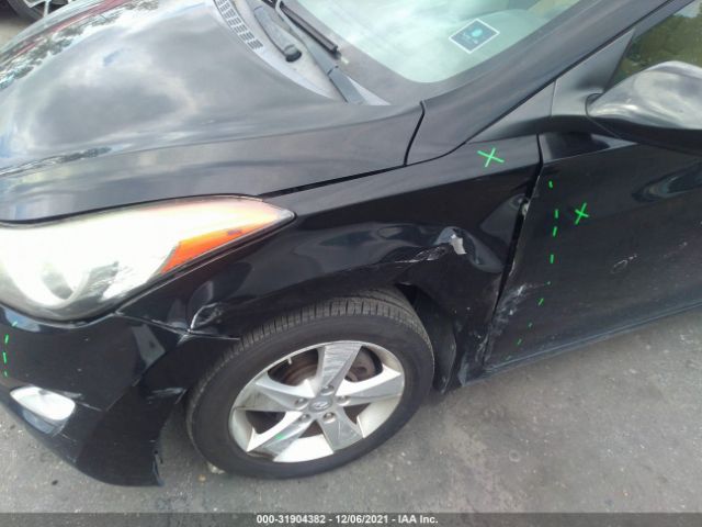 Photo 5 VIN: KMHDH4AE6CU479691 - HYUNDAI ELANTRA 