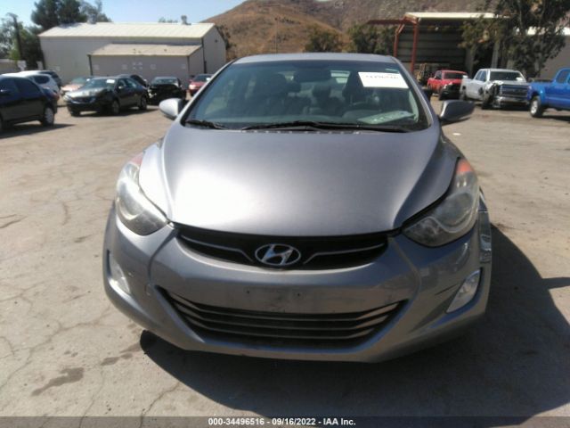 Photo 5 VIN: KMHDH4AE6DU687636 - HYUNDAI ELANTRA 