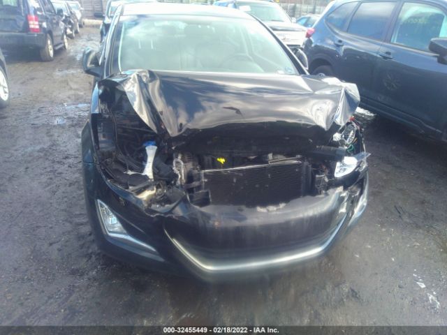 Photo 5 VIN: KMHDH4AE6EU189180 - HYUNDAI ELANTRA 