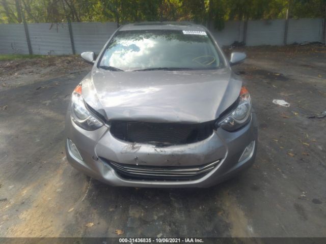 Photo 5 VIN: KMHDH4AE7CU496404 - HYUNDAI ELANTRA 