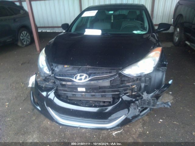 Photo 5 VIN: KMHDH4AE8DU755225 - HYUNDAI ELANTRA 