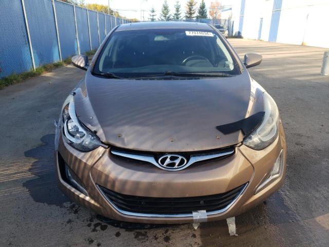 Photo 4 VIN: KMHDH4AH0FU361280 - HYUNDAI ELANTRA SE 