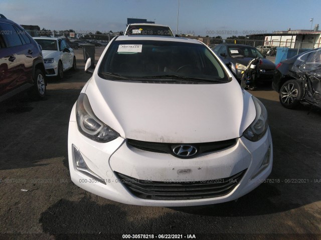 Photo 5 VIN: KMHDH4AH6FU321155 - HYUNDAI ELANTRA 