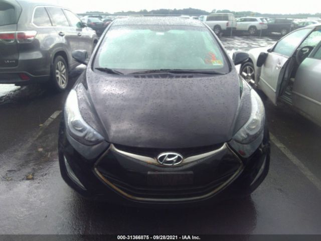 Photo 5 VIN: KMHDH6AH5EU024081 - HYUNDAI ELANTRA COUPE 