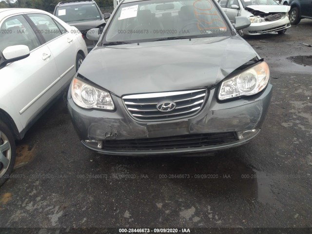 Photo 5 VIN: KMHDU4AD0AU863658 - HYUNDAI ELANTRA 