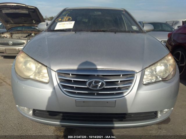 Photo 5 VIN: KMHDU4AD0AU990412 - HYUNDAI ELANTRA 