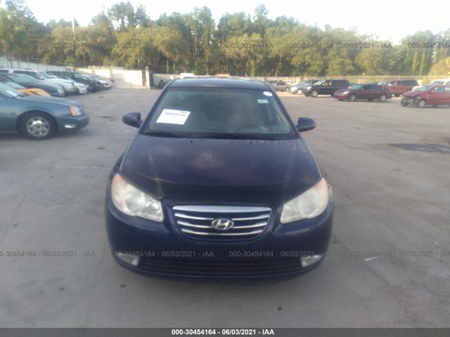 Photo 5 VIN: KMHDU4AD1AU029933 - HYUNDAI ELANTRA 