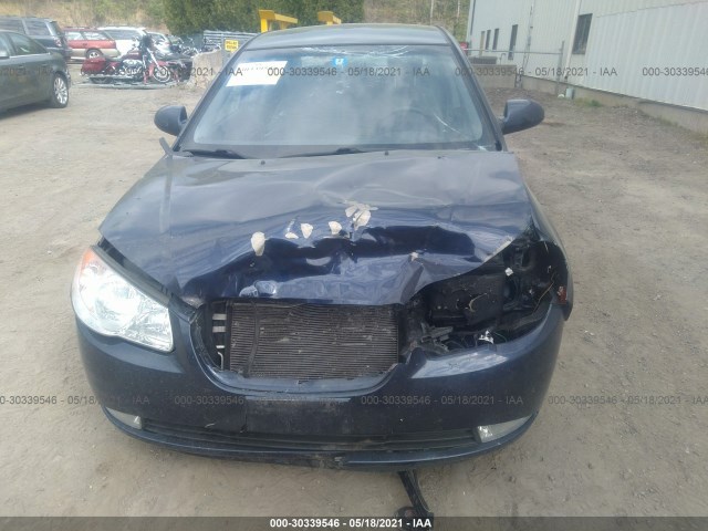 Photo 5 VIN: KMHDU4AD1AU155015 - HYUNDAI ELANTRA 