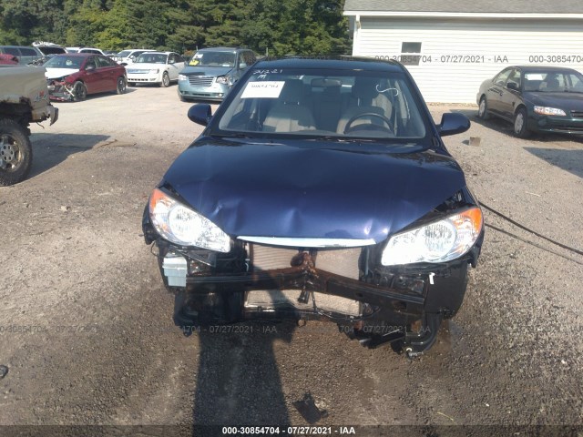 Photo 5 VIN: KMHDU4AD2AU904081 - HYUNDAI ELANTRA 