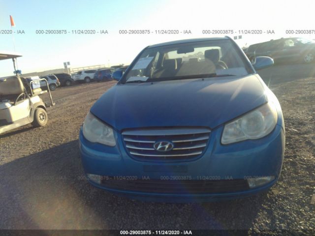 Photo 5 VIN: KMHDU4AD3AU084948 - HYUNDAI ELANTRA 