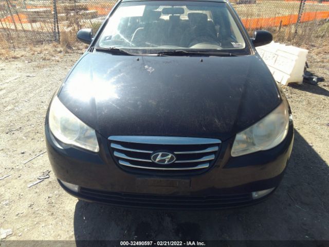 Photo 5 VIN: KMHDU4AD3AU957243 - HYUNDAI ELANTRA 