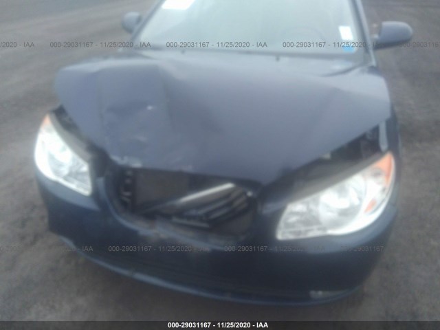 Photo 5 VIN: KMHDU4AD4AU163402 - HYUNDAI ELANTRA 