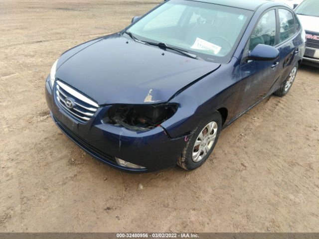 Photo 5 VIN: KMHDU4AD4AU920511 - HYUNDAI ELANTRA 