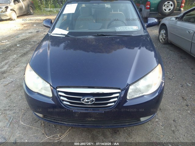 Photo 5 VIN: KMHDU4AD4AU923716 - HYUNDAI ELANTRA 