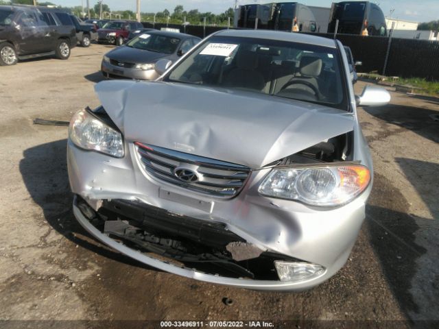 Photo 5 VIN: KMHDU4AD4AU947305 - HYUNDAI ELANTRA 