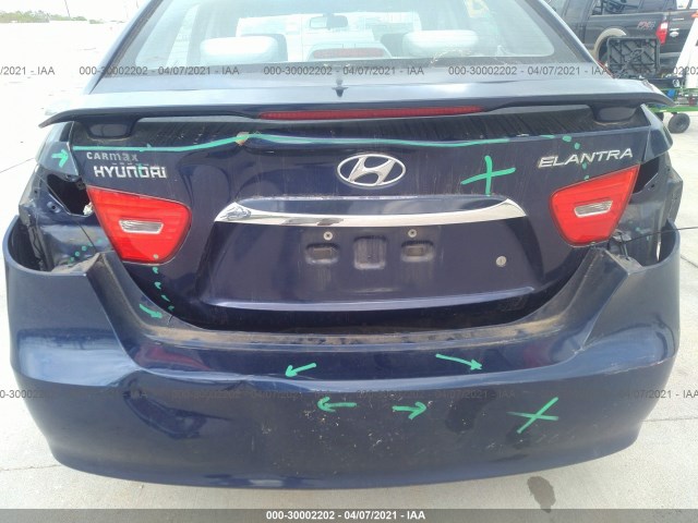 Photo 5 VIN: KMHDU4AD5AU191449 - HYUNDAI ELANTRA 