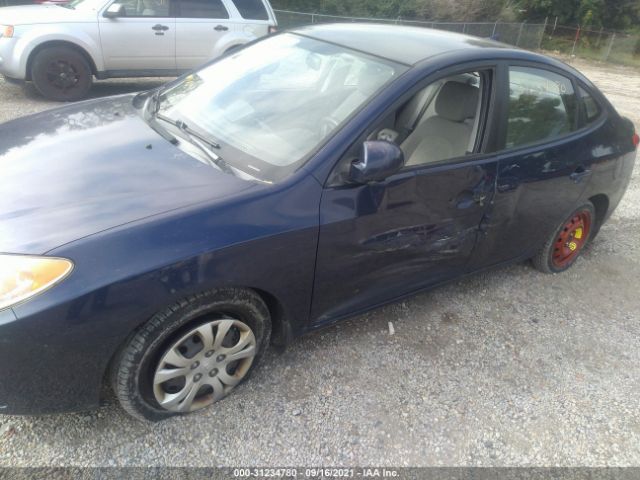 Photo 5 VIN: KMHDU4AD7AU956581 - HYUNDAI ELANTRA 