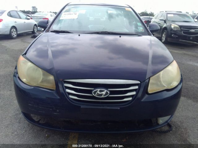 Photo 5 VIN: KMHDU4AD8AU136686 - HYUNDAI ELANTRA 