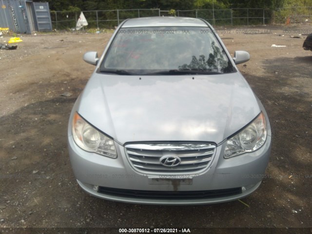 Photo 5 VIN: KMHDU4AD8AU854240 - HYUNDAI ELANTRA 