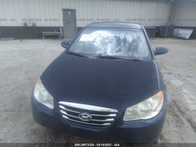 Photo 5 VIN: KMHDU4ADXAU836970 - HYUNDAI ELANTRA 