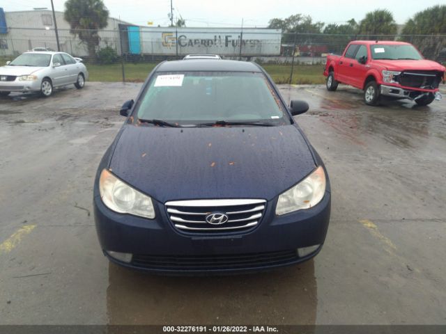 Photo 5 VIN: KMHDU4ADXAU867295 - HYUNDAI ELANTRA 