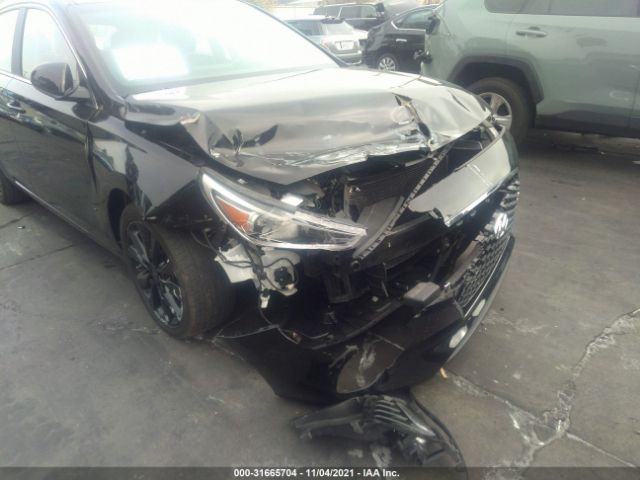 Photo 5 VIN: KMHH35LE3LU146156 - HYUNDAI ELANTRA GT 