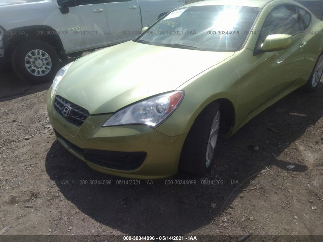 Photo 5 VIN: KMHHT6KD8AU037123 - HYUNDAI GENESIS COUPE 