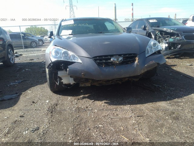 Photo 5 VIN: KMHHU6KH0AU023720 - HYUNDAI GENESIS COUPE 