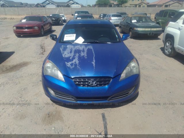 Photo 5 VIN: KMHHU6KH5AU007805 - HYUNDAI GENESIS COUPE 