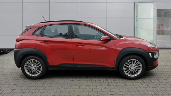 Photo 6 VIN: KMHK2815HJU104631 - HYUNDAI KONA SUV 