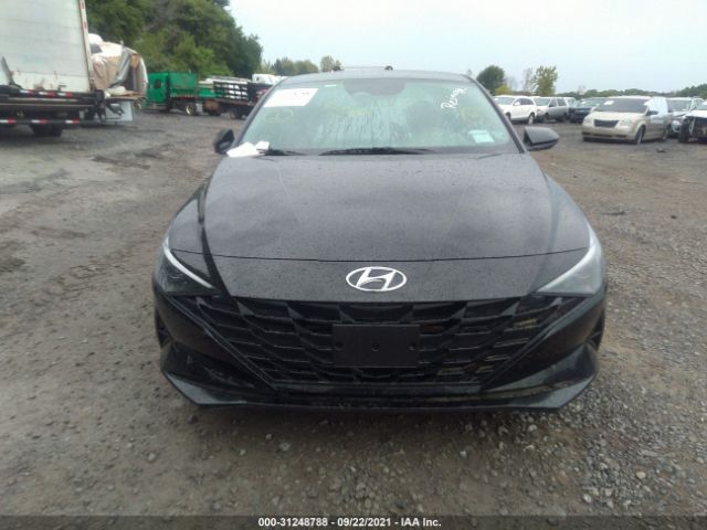 Photo 5 VIN: KMHLL4AG9MU180550 - HYUNDAI ELANTRA 