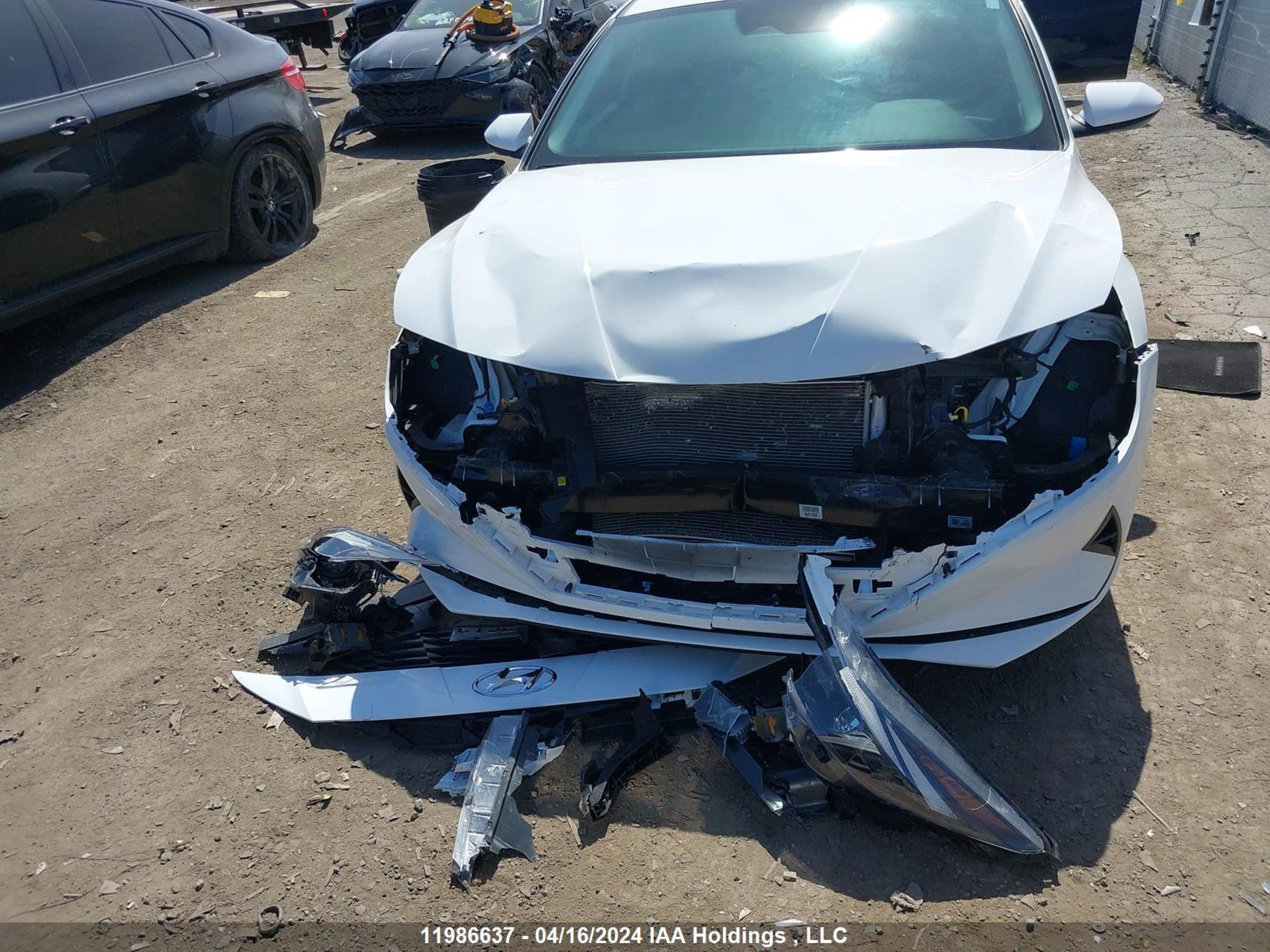 Photo 5 VIN: KMHLM4AGXPU531659 - HYUNDAI ELANTRA 