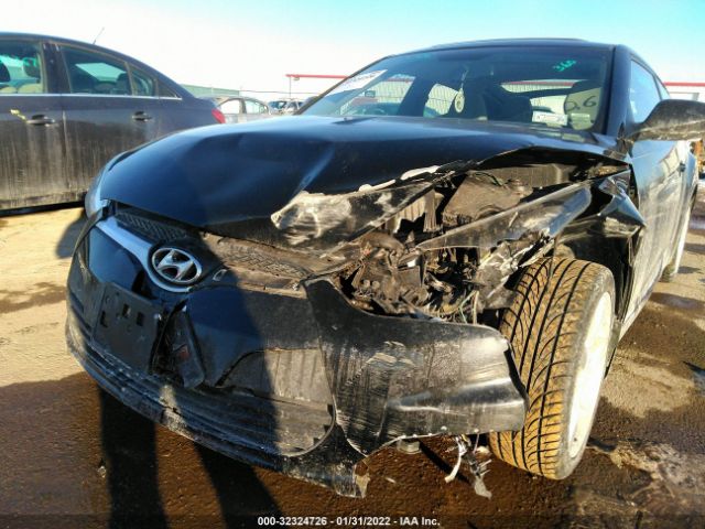 Photo 5 VIN: KMHTC6AD0DU142254 - HYUNDAI VELOSTER 