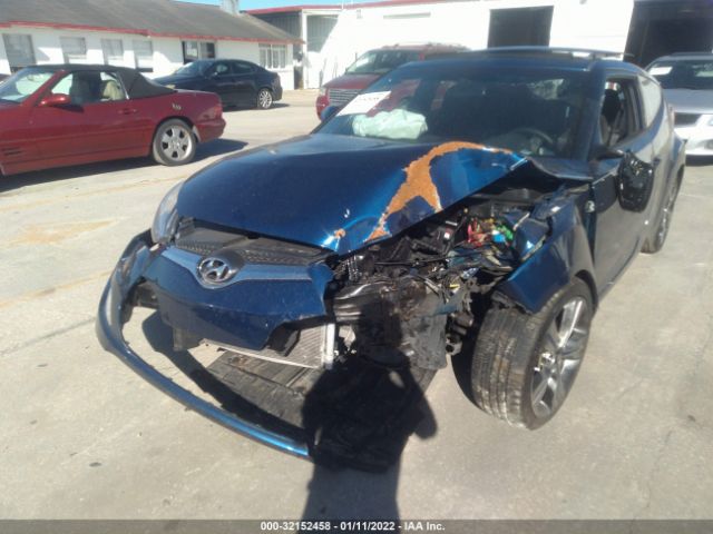 Photo 5 VIN: KMHTC6AD0HU322226 - HYUNDAI VELOSTER 