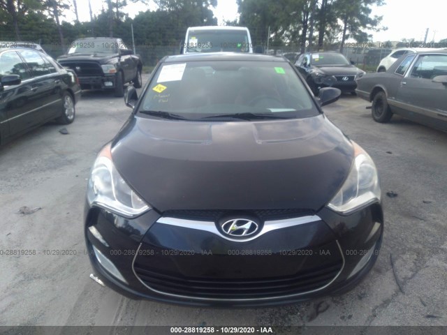 Photo 5 VIN: KMHTC6AD1CU078465 - HYUNDAI VELOSTER 