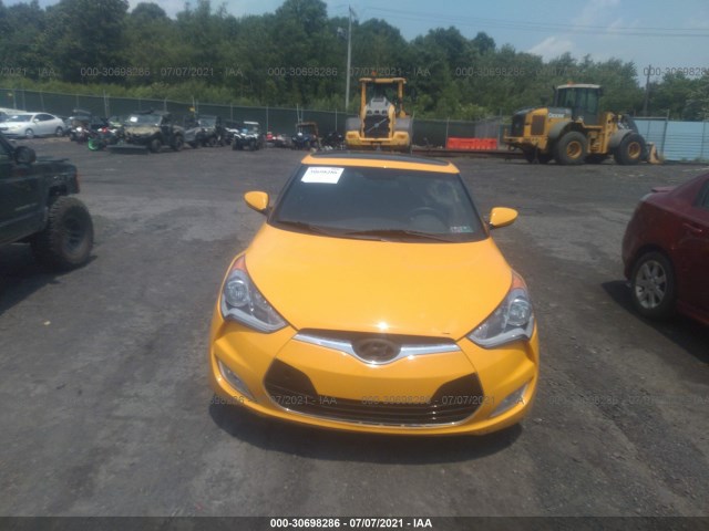 Photo 5 VIN: KMHTC6AD1HU317777 - HYUNDAI VELOSTER 