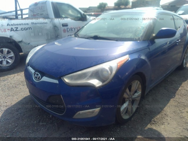 Photo 5 VIN: KMHTC6AD3CU072330 - HYUNDAI VELOSTER 