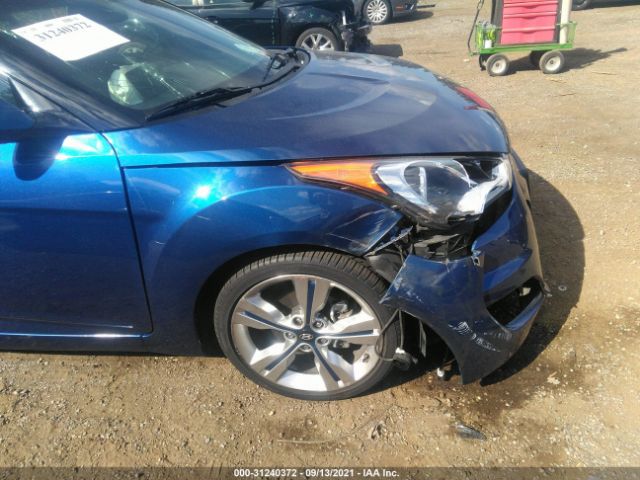 Photo 5 VIN: KMHTC6AD3HU313617 - HYUNDAI VELOSTER 