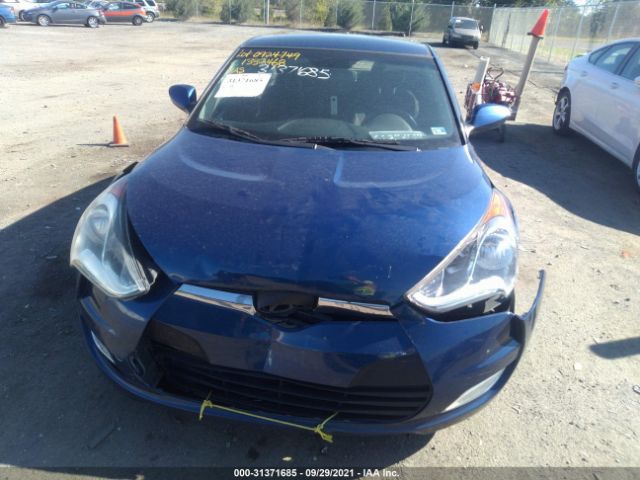 Photo 5 VIN: KMHTC6AD4HU310015 - HYUNDAI VELOSTER 