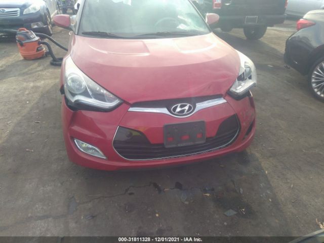 Photo 5 VIN: KMHTC6AD4HU324304 - HYUNDAI VELOSTER 