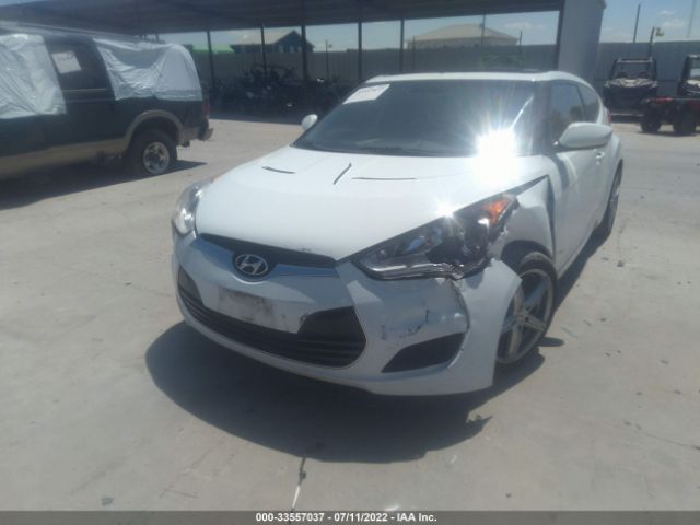 Photo 5 VIN: KMHTC6AD5EU210078 - HYUNDAI VELOSTER 