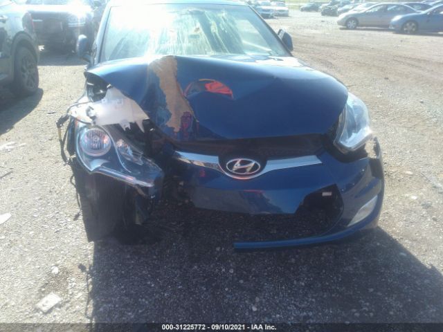 Photo 5 VIN: KMHTC6AD5HU319225 - HYUNDAI VELOSTER 