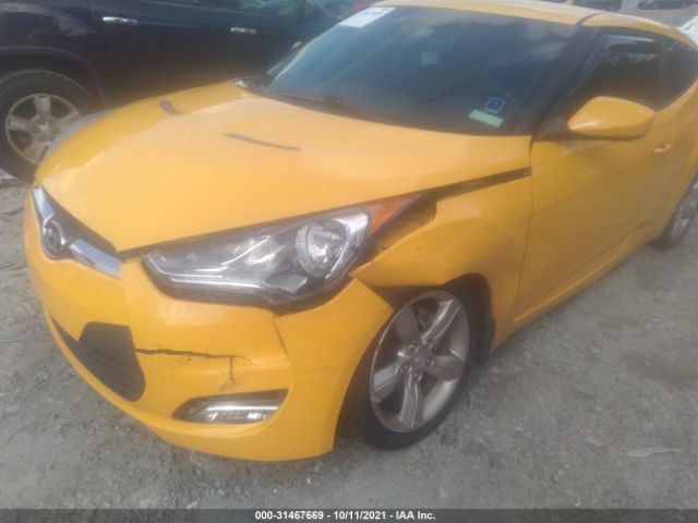 Photo 5 VIN: KMHTC6AD7CU046684 - HYUNDAI VELOSTER 