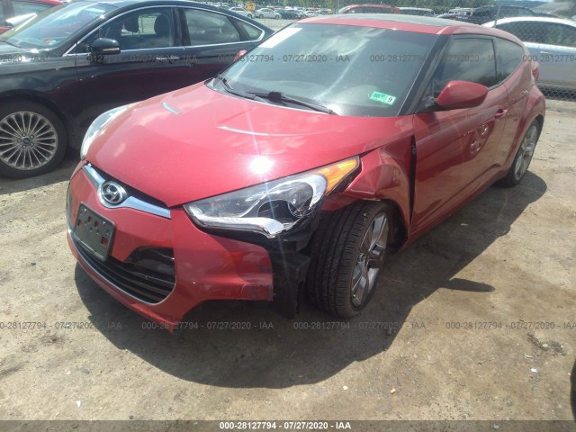 Photo 5 VIN: KMHTC6AD8CU078558 - HYUNDAI VELOSTER 