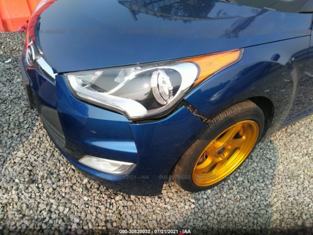 Photo 5 VIN: KMHTC6AD9HU310530 - HYUNDAI VELOSTER 