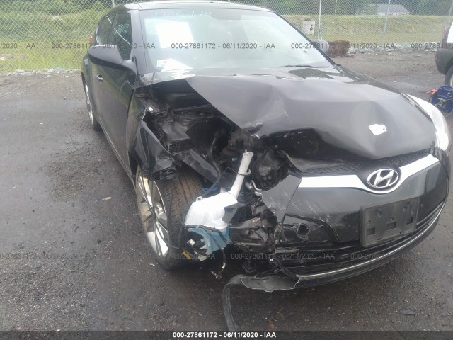 Photo 5 VIN: KMHTC6AD9HU321625 - HYUNDAI VELOSTER 