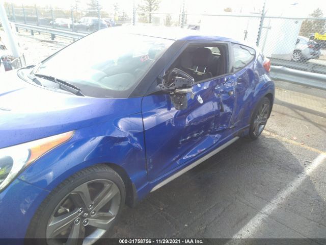 Photo 5 VIN: KMHTC6AE0EU195188 - HYUNDAI VELOSTER 